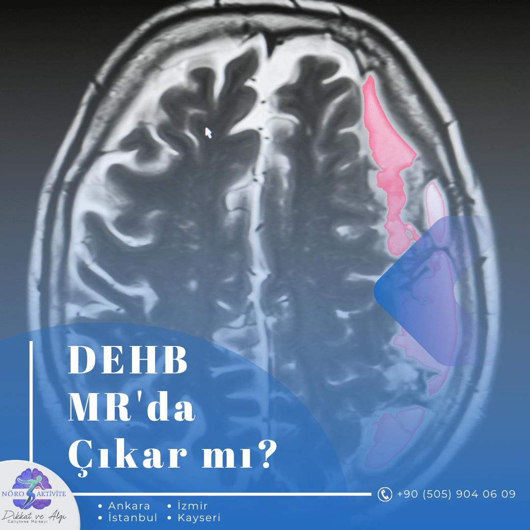DEHB Mr da Çıkar mı?